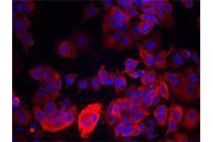 Immunofluorescence (IF) image for anti-Keratin 19 (KRT19) antibody (ABIN2664919) (Cytokeratin 19 抗体)