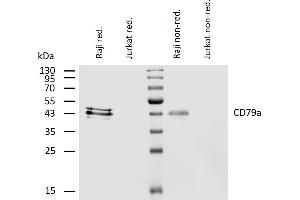 Western blotting analysis of human CD79a using mouse monoclonal antibody HM47 on lysates of Raji and Jurkat (negative control) cell line under reducing and non-reducing conditions. (CD79a 抗体  (AA 208-222))