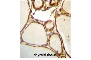 HJURP Antibody (C-term) (ABIN657329 and ABIN2846399) immunohistochemistry analysis in formalin fixed and paraffin embedded human thyroid tissue followed by peroxidase conjugation of the secondary antibody and DAB staining. (HJURP 抗体  (C-Term))