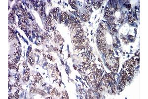 Immunohistochemistry (IHC) image for anti-SRY (Sex Determining Region Y)-Box 11 (SOX11) (AA 1-250) antibody (ABIN7193570)