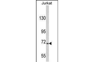 Western blot analysis of hUSP19-L1304 in Jurkat cell line lysates (35ug/lane) (USP19 抗体  (C-Term))