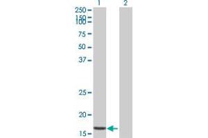 Western Blot analysis of STK10 expression in transfected 293T cell line by STK10 MaxPab polyclonal antibody. (STK10-A 抗体  (AA 12-144))