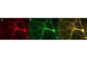 Indirect immunostaining of hippocampus neurons  (dilution 1 : 500) (NSF 抗体  (AA 733-744))