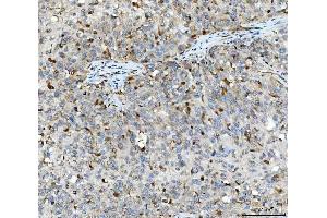 IHC analysis of Aurora A/AURKA using anti-Aurora A/AURKA antibody (ABIN7600751).