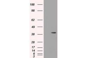 Image no. 3 for anti-3-hydroxyisobutyryl-CoA Hydrolase (HIBCH) antibody (ABIN1498658) (HIBCH 抗体)