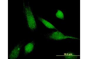 Immunofluorescence (IF) image for anti-ATP-Binding Cassette, Sub-Family C (CFTR/MRP), Member 11 (ABCC11) (AA 433-532) antibody (ABIN529878)