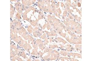 Immunohistochemistry of paraffin-embedded Human stomach using ABCC5 Polyclonal Antibody at dilution of 1:100 (40x lens). (ABCC5 抗体)
