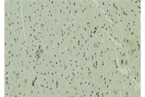ABIN6272476 at 1/100 staining Mouse muscle tissue by IHC-P. (UBE2E3 抗体  (N-Term))