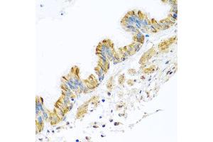 Immunohistochemistry of paraffin-embedded human trachea using PCDHA12 antibody at dilution of 1:100 (x40 lens). (PCDHA12 抗体)