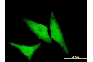 Immunofluorescence (IF) image for anti-Heat Shock 27kDa Protein 1 (HSPB1) (AA 96-205) antibody (ABIN516740)
