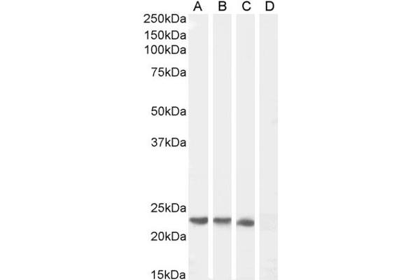 SOCS1 抗体  (C-Term)