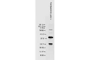 Western blot analysis of Rat Skeletal muscle lysates showing detection of HSP22 protein using Rabbit Anti-HSP22 Polyclonal Antibody (ABIN361851 and ABIN361852). (HSPB8 抗体)