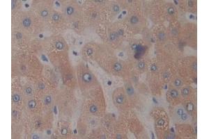 DAB staining on IHC-P; Samples: Human Liver Tissue (PTX3 抗体  (AA 183-381))