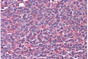 Immunohistochemistry (Formalin-fixed Paraffin-embedded Sections) (IHC (fp)) image for anti-Calcium/calmodulin-Dependent Protein Kinase II beta (CAMK2B) (AA 1-504) antibody (ABIN574217)