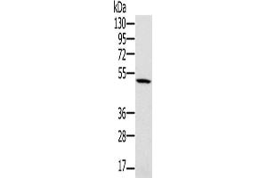 Western Blotting (WB) image for anti-Proteasome (Prosome, Macropain) 26S Subunit, ATPase, 2 (PSMC2) antibody (ABIN2423817) (PSMC2 抗体)