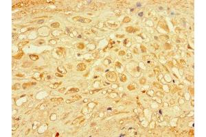 Immunohistochemistry of paraffin-embedded human placenta tissue using ABIN7166973 at dilution of 1:100 (CHM 抗体  (AA 1-653))
