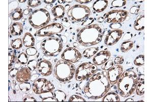 Immunohistochemical staining of paraffin-embedded Human Kidney tissue using anti-TBXAS1 mouse monoclonal antibody. (TBXAS1 抗体)