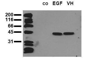 Western Blotting (WB) image for anti-Mitogen-Activated Protein Kinase 3 (MAPK3) (pThr-Glu-pTyr) antibody (ABIN126831) (ERK1 抗体  (pThr-Glu-pTyr))