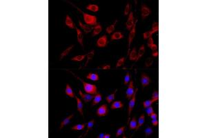 Immunofluorescence analysis of PC-12 cells using FGFR2 antibody (ABIN6130457, ABIN6140615, ABIN6140617 and ABIN6216059) at dilution of 1:100 (40x lens). (FGFR2 抗体  (AA 245-345))