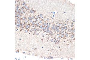 Immunohistochemistry of paraffin-embedded mouse brain using P Rabbit mAb (ABIN7269161) at dilution of 1:100 (40x lens). (PAK3 抗体)