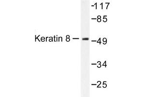 Image no. 1 for anti-Keratin 8 (KRT8) antibody (ABIN265504) (KRT8 抗体)