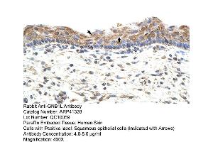 Rabbit Anti-GNB1L Antibody  Paraffin Embedded Tissue: Human Skin Cellular Data: Squamous epithelial cells Antibody Concentration: 4. (GNB1L 抗体  (C-Term))