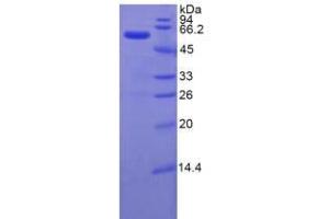 SDS-PAGE analysis of Rat ITIH4 Protein. (ITIH4 蛋白)
