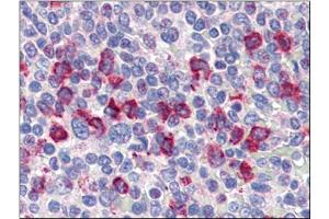 Human Spleen (formalin-fixed, paraffin-embedded) stained with CD14at 4 µg/ml followed by biotinylated anti-goat IgG secondary antibody, alkaline phosphatase-streptavidin and chromogen. (CD14 抗体)