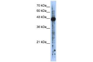 RBMS2 antibody used at 1 ug/ml to detect target protein. (RBMS2 抗体  (N-Term))