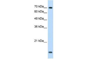 UBE2L3 antibody used at 1. (UBE2L3 抗体  (C-Term))