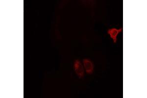 ABIN6268685 staining MCF7 cells by ICC/IF. (CD9 抗体  (Internal Region))