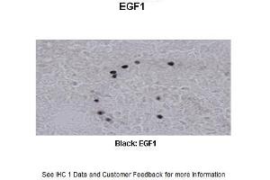 Sample Type :  Frog brain  Primary Antibody Dilution :  1:500  Secondary Antibody :  Biotinylated goat anti-rabbit  Secondary Antibody Dilution :  1:200  Color/Signal Descriptions :  Black: EGF1  Gene Name :  EGR1 a  Submitted by :  Eva Fischer, Colorado State University (EGR1 抗体  (N-Term))
