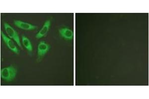 Immunofluorescence analysis of HeLa cells, using S6 Ribosomal Protein (Ab-240) Antibody. (RPS6 抗体  (AA 191-240))