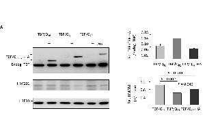 HMGB1 dysfunction in TBP/Q61~79 SH-SY5Y cells and the associated neuronal phenotype. (Histone H3.3B 抗体  (full length))