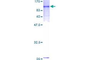 Image no. 1 for Interleukin 21 Receptor (IL21R) (AA 1-538) protein (GST tag) (ABIN1307776)