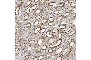 IHC analysis of ACAD9 using anti-ACAD9 antibody (ABIN7602670).