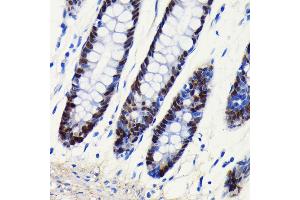 Immunohistochemistry of paraffin-embedded human colon using SOX9 antibody (ABIN7270577) at dilution of 1:100 (40x lens). (SOX9 抗体)