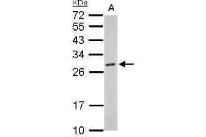 WB Image Proteasome 20S alpha 6 antibody detects PSMA6 protein by Western blot analysis. (PSMA6 抗体  (Center))