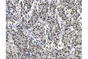anti-THO Complex 2 (THOC2) antibody