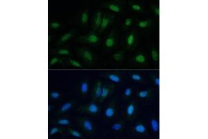 Immunofluorescence analysis of U-2 OS cells using ETS2 antibody (ABIN6133259, ABIN6140325, ABIN6140326 and ABIN6223170) at dilution of 1:100. (ETS2 抗体  (AA 160-350))