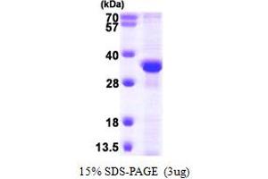 SDS-PAGE (SDS) image for Replication Protein A2, 32kDa (RPA2) (AA 1-270) protein (His tag) (ABIN7279229)