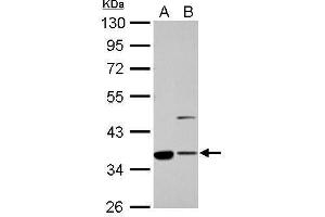 WB Image Annexin II antibody [N1], N-term detects ANXA2 protein by Western blot analysis. (Annexin A2 抗体  (N-Term))