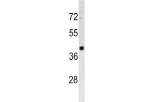 Western blot analysis of TROP2 antibody and HL-60 lysate. (TACSTD2 抗体  (AA 162-190))