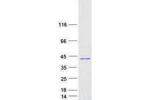Validation with Western Blot (HYLS1 Protein (Transcript Variant 1) (Myc-DYKDDDDK Tag))