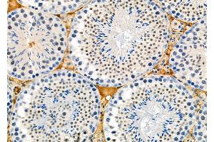 ABIN6261407 and ABIN6273114 at 1/100 staining Mouse testis tissue by IHC-P. (DYX1C1 抗体  (Internal Region))
