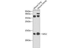 Western blot analysis of extracts of various cell lines, using G0S2 Antibody (ABIN6134775, ABIN6140856, ABIN6140858 and ABIN6225312) at 1:1000 dilution. (G0S2 抗体  (AA 1-100))