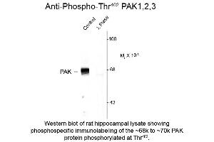 Western blot of Anti-PAK 1/2/3 pT402 (Rabbit) Antibody - 612-401-E05 Western Blot of Rabbit anti-PAK 1/2/3 pT402 antibody. (PAK1/2/3 抗体  (pThr402))