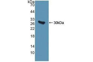 Detection of Recombinant QDPR, Human using Polyclonal Antibody to Quinoid Dihydropteridine Reductase (QDPR) (QDPR 抗体  (AA 1-244))