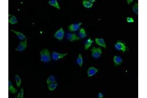 Immunofluorescence staining of Hela cells with ABIN7159440 at 1:50, counter-stained with DAPI. (Metabotropic Glutamate Receptor 3 抗体  (AA 46-354))