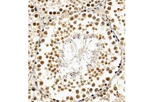 Immunohistochemistry (Paraffin-embedded Sections) (IHC (p)) image for anti-Chromodomain Protein, Y-Linked, 1 (CDY1) antibody (ABIN7073493)